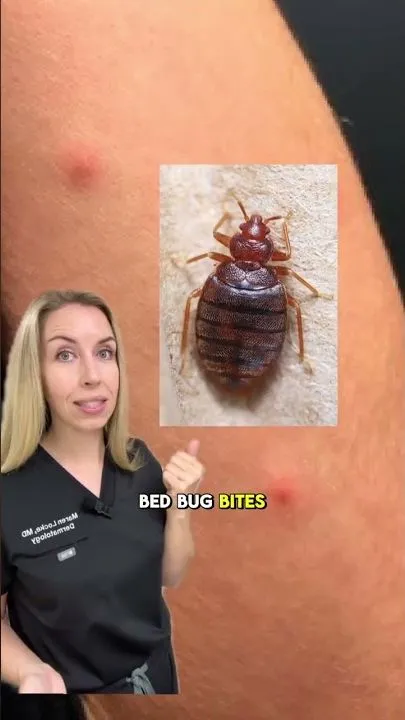 Send this a friend who thinks every bite is a spider bite! 👀